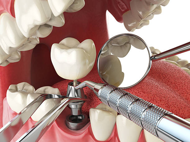 Best Urgent Tooth Repair  in Morrisonville, NY